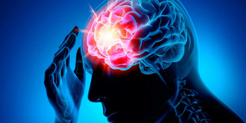 Blood group linked to early stroke risk: study results